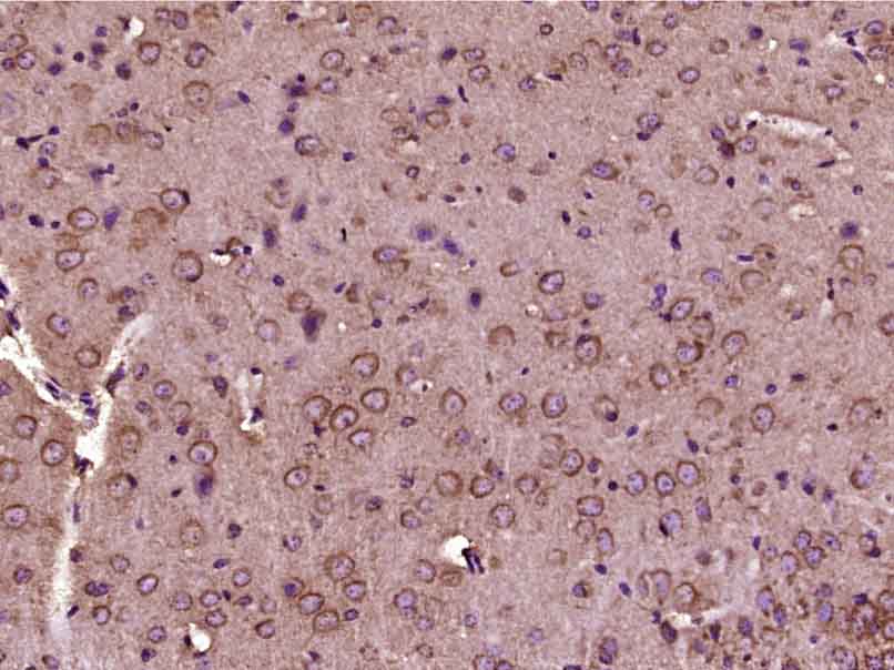 14 - SGSM2 Rabbit pAb AP57645