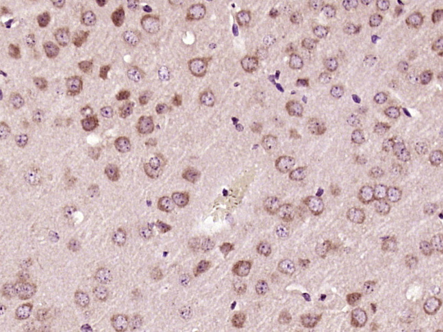 14 - SH3BP1 Rabbit pAb AP57650