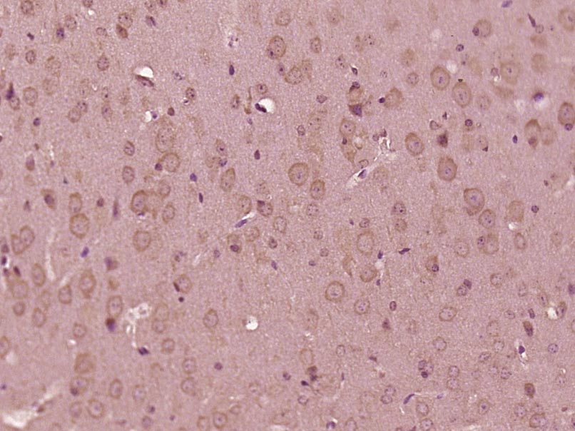 14 - RBM25 Rabbit pAb AP57655
