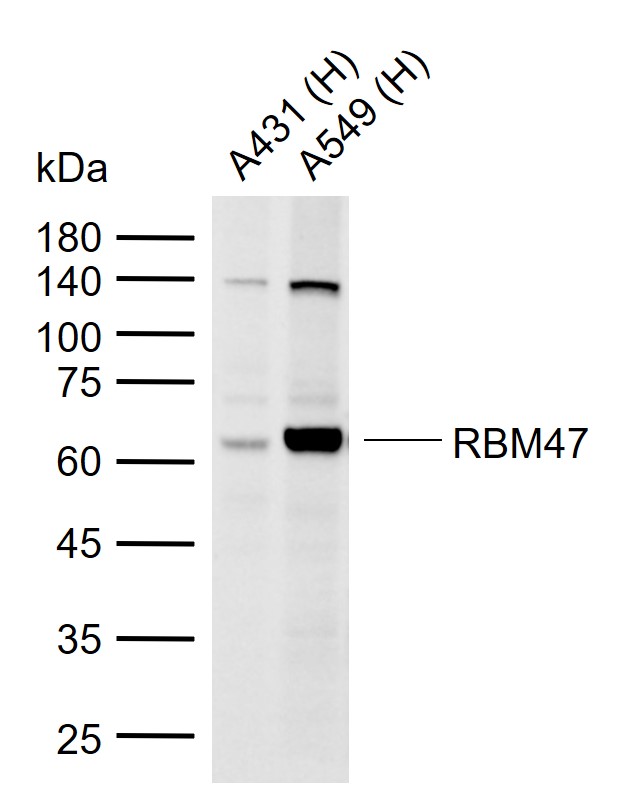1 - RBM47 Rabbit pAb AP57657