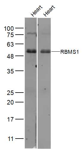 1 - RBMS1/Cervical cancer oncogene 4 Rabbit pAb AP57658