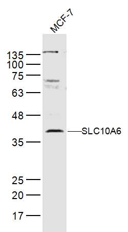 1 - SLC10A6 Rabbit pAb AP57664