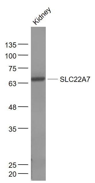 1 - SLC22A7 Rabbit pAb AP57670