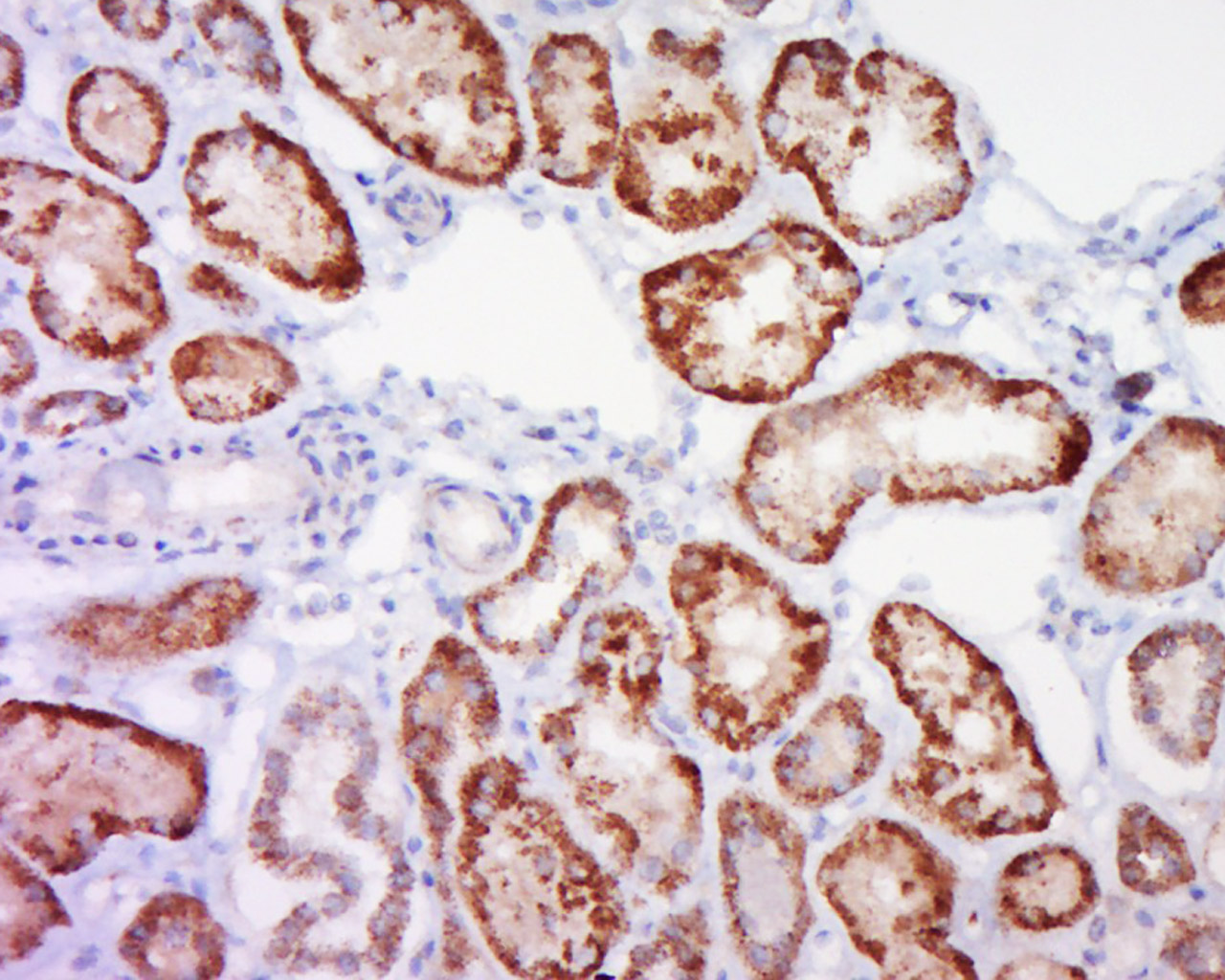 14 - SLC34A1 Rabbit pAb AP57671