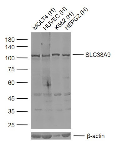 1 - SLC38A9 Rabbit pAb AP57677