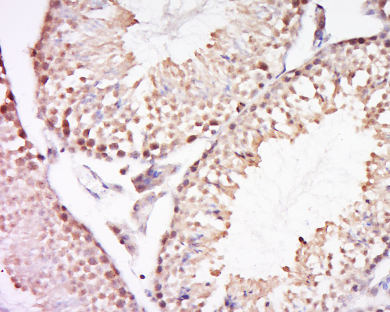 14 - REV3L/Polymerase DNA zeta Rabbit pAb AP57682