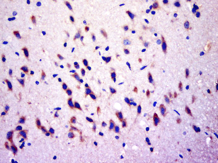 14 - RGS17 Rabbit pAb AP57689