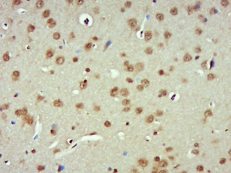 14 - PARN Rabbit pAb AP57698