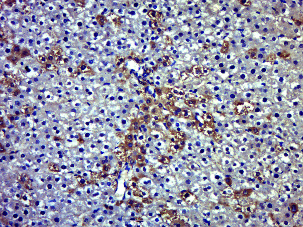 14 - PARP14 Rabbit pAb AP57700