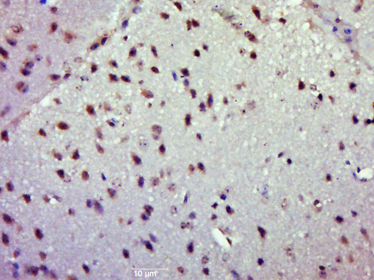14 - PASK/STK37 Rabbit pAb AP57704