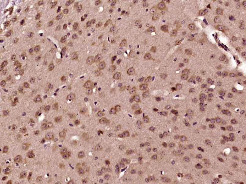 14 - PCBP2 Rabbit pAb AP57710