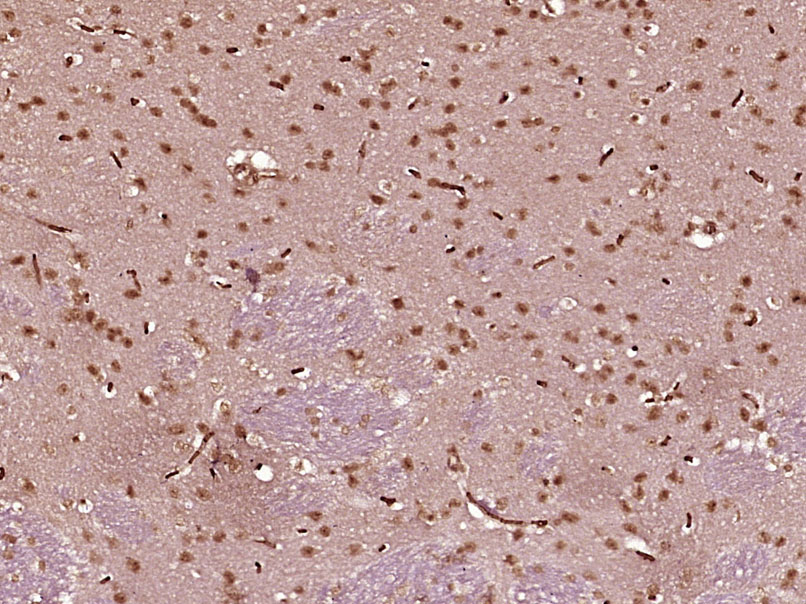 14 - SMCHD1 Rabbit pAb AP57717