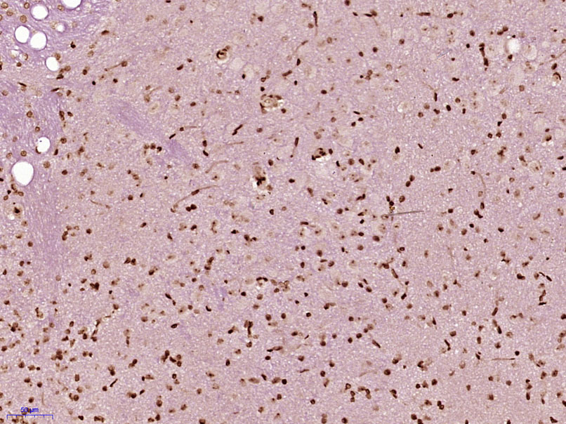 14 - TINP1/NSA2 Rabbit pAb AP57721