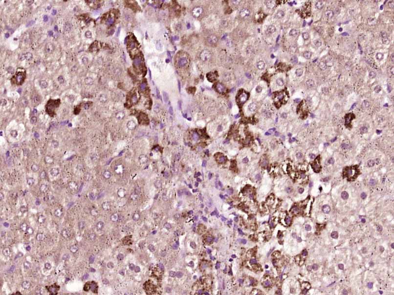 14 - TKTL2 Rabbit pAb AP57722