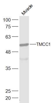1 - TMCC1 Rabbit pAb AP57725