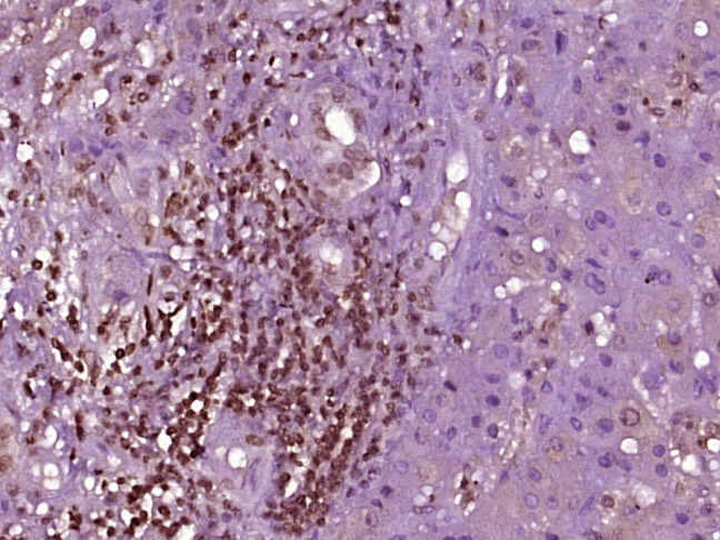 14 - PRDM7 Rabbit pAb AP57730