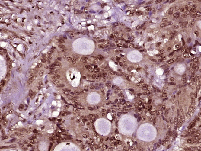 14 - PRKRIR Rabbit pAb AP57735