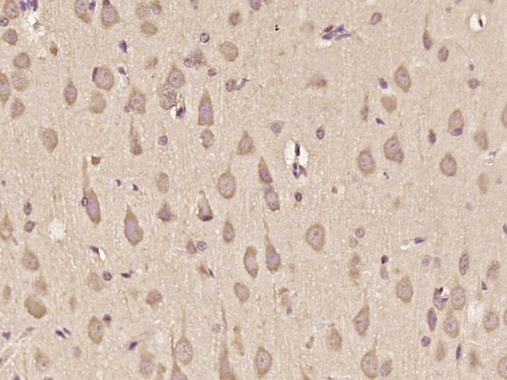 14 - PPP2R2D Rabbit pAb AP57736