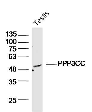 1 - PPP3CC Rabbit pAb AP57737