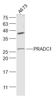 1 - PRADC1 Rabbit pAb AP57742