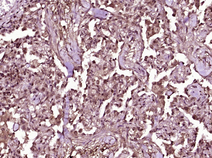 14 - TBX5 Rabbit pAb AP57755