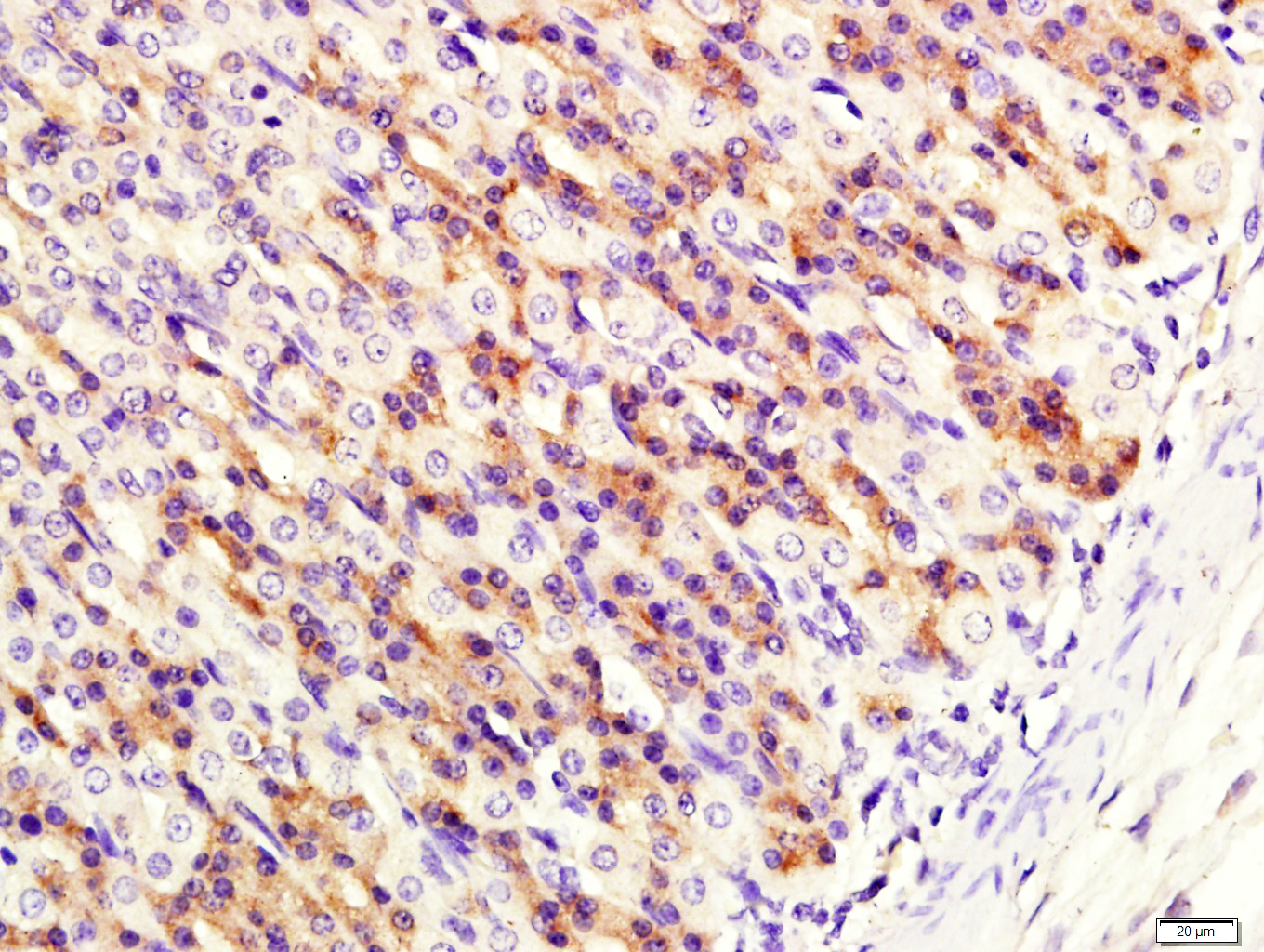 14 - UGT1A7 Rabbit pAb AP57757