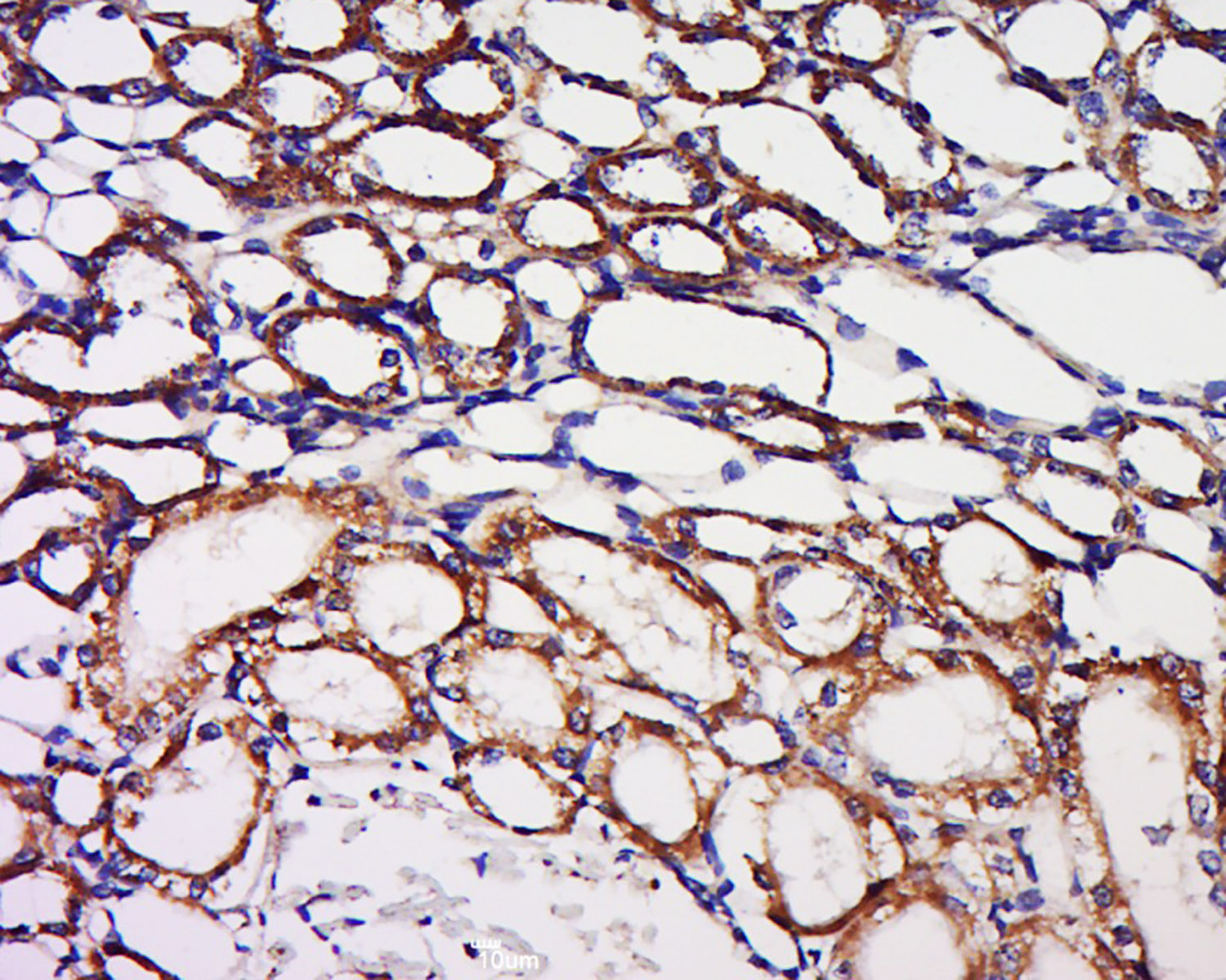 14 - BPNT1 Rabbit pAb AP57768