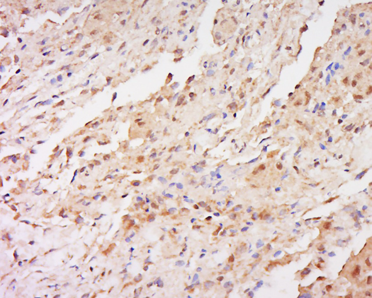 14 - FAM166A Rabbit pAb AP57769