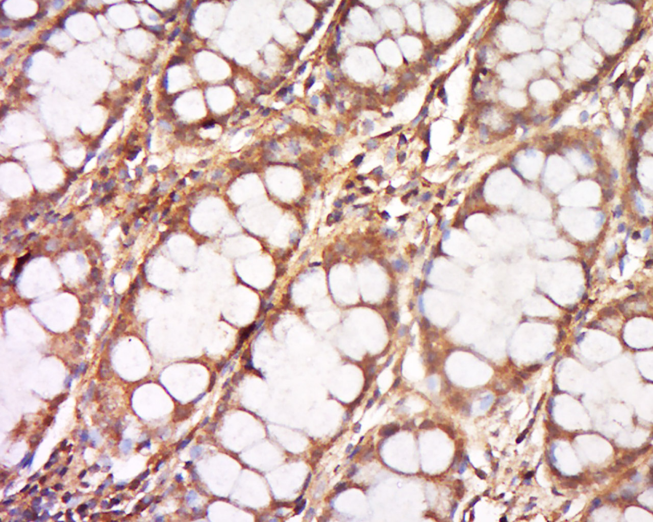 14 - DNCLI1 Rabbit pAb AP57771