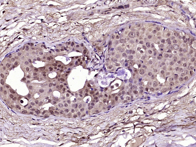 14 - ALPK3 Rabbit pAb AP57772