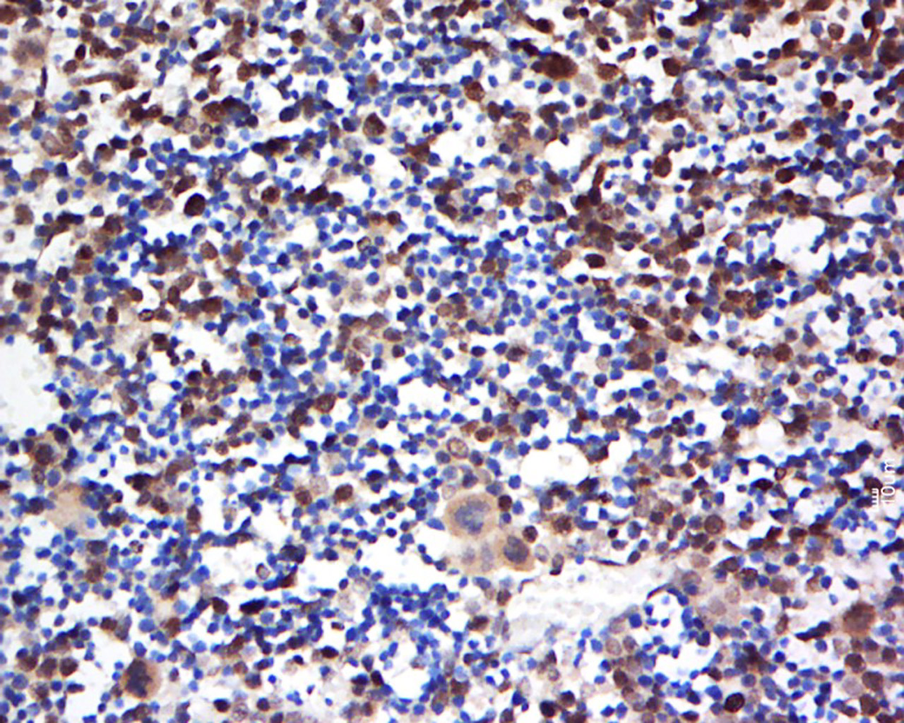 14 - SNRPE Rabbit pAb AP57773