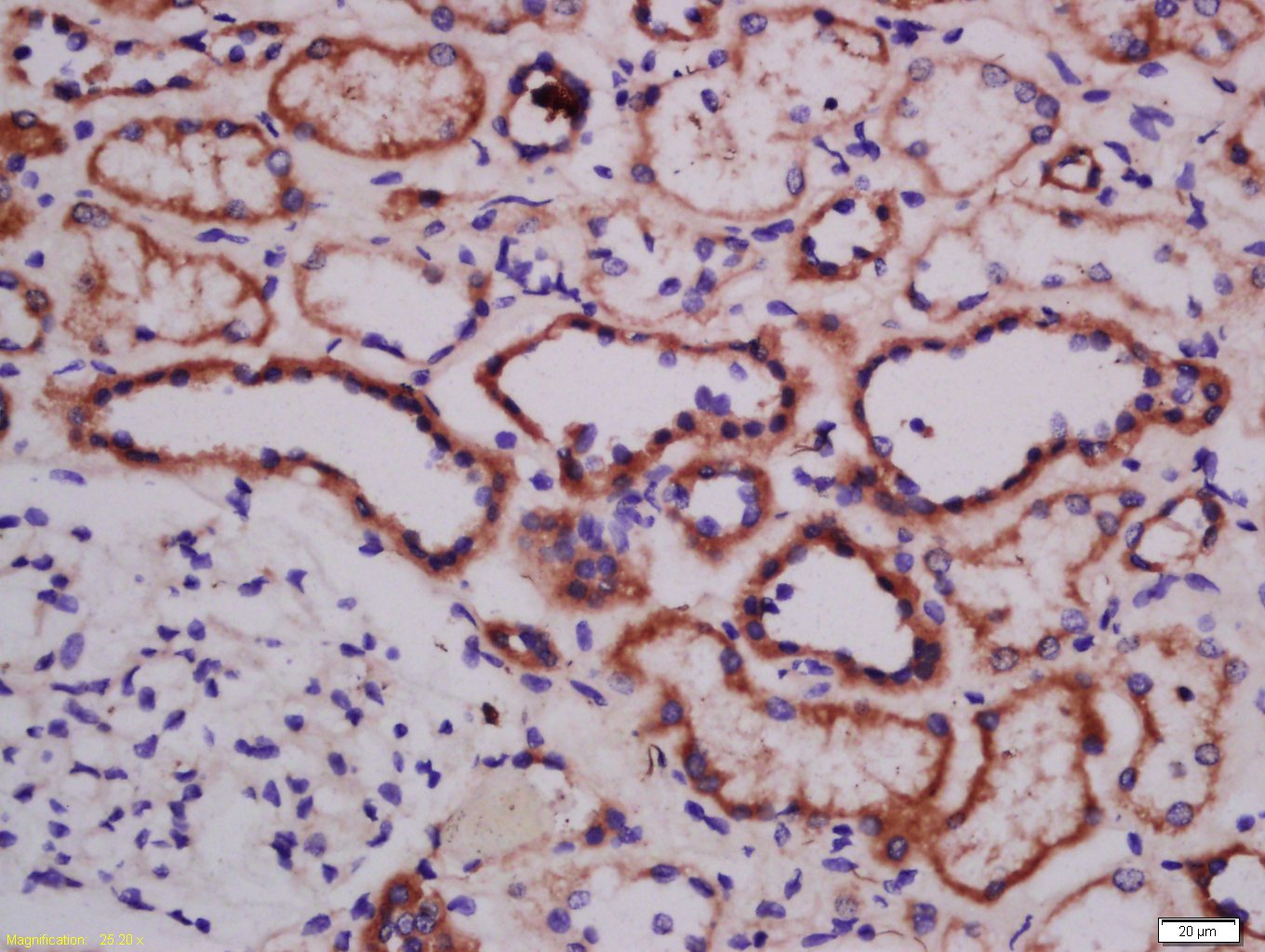 14 - ATG101 Rabbit pAb AP57778