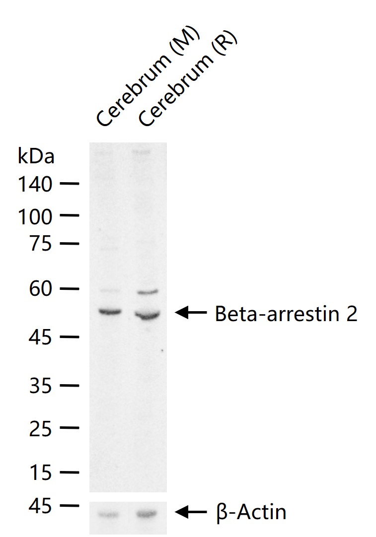 1 - Beta-arrestin 2 Rabbit pAb AP57781
