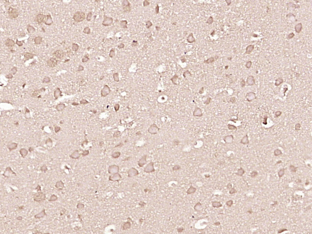 14 - Beta-arrestin 2 Rabbit pAb AP57781