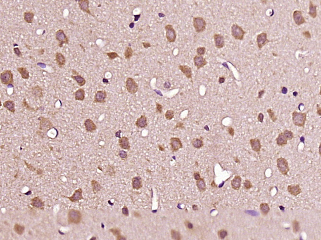 14 - HAP1 Rabbit pAb AP57785