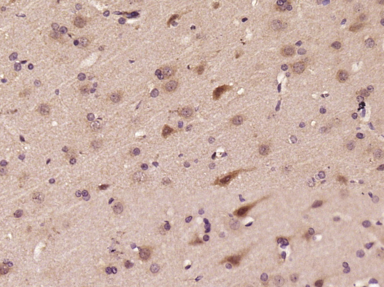 14 - ASB5 Rabbit pAb AP57791