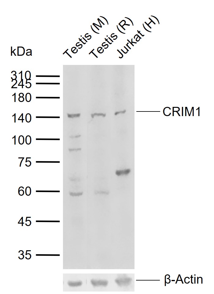 1 - CRIM1 Rabbit pAb AP57792