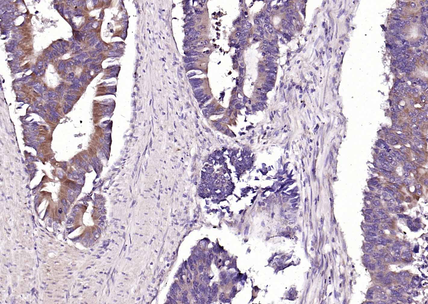 14 - CRIM1 Rabbit pAb AP57792