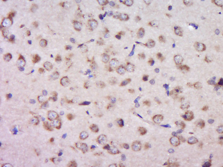 14 - PTPRS Rabbit pAb AP57795