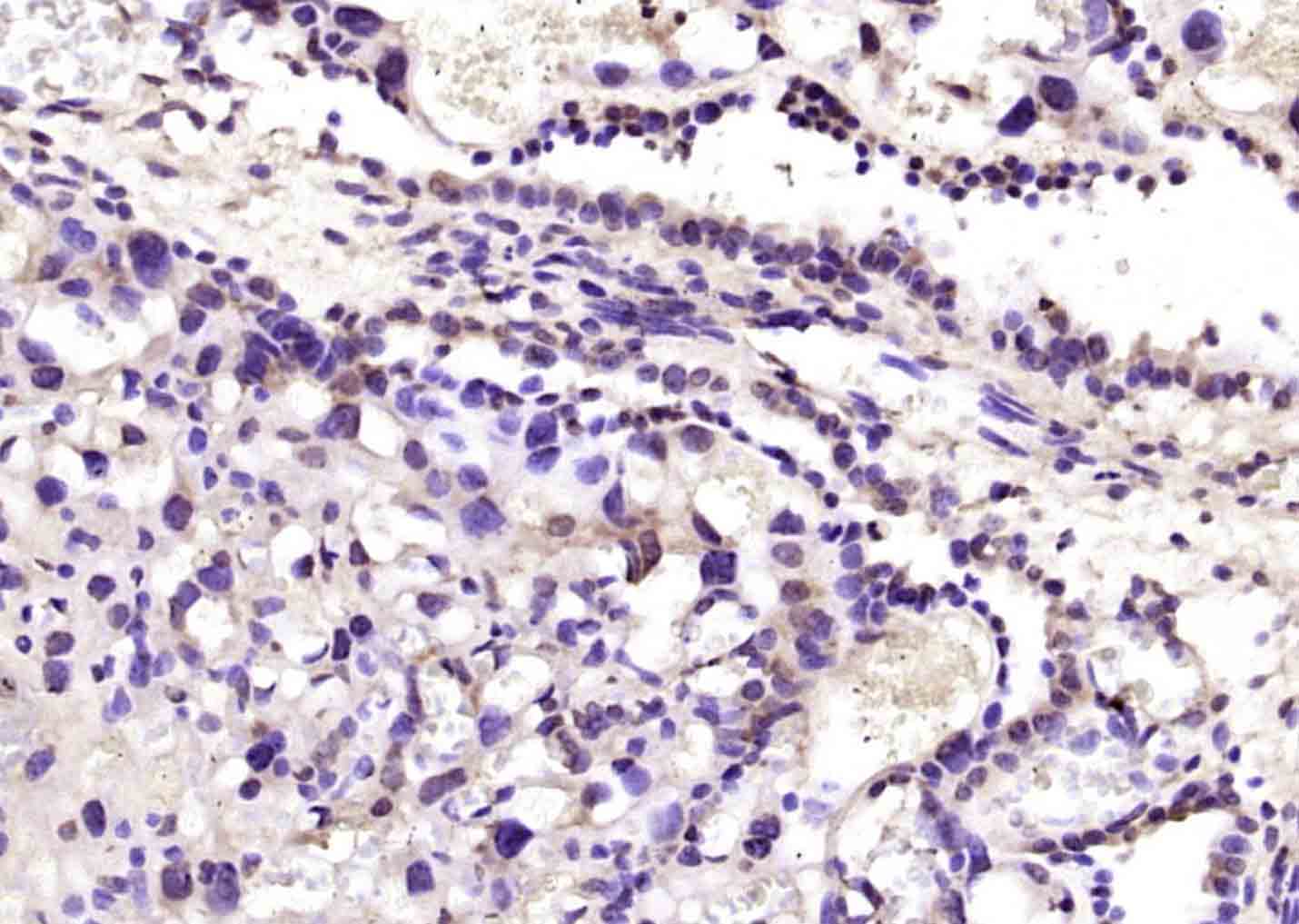 14 - RYBP Rabbit pAb AP57804