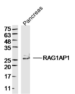 1 - RAG1AP1 Rabbit pAb AP57810
