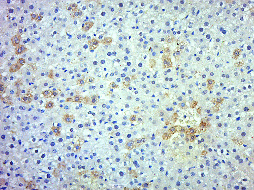 14 - SERPIN A11 Rabbit pAb AP57811
