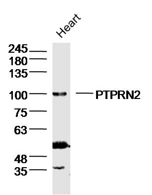 1 - PTPRN2 Rabbit pAb AP57812