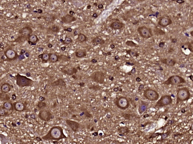 14 - SPINK13 Rabbit pAb AP57813