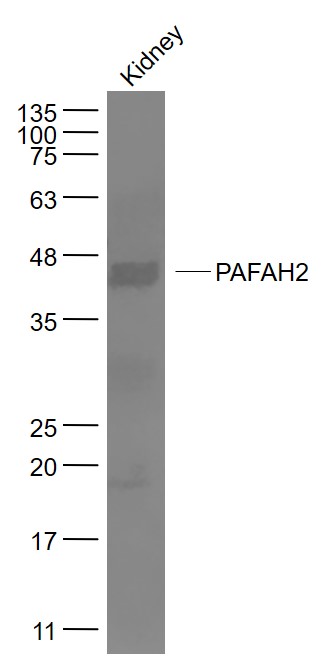 1 - PAFAH2 Rabbit pAb AP57817