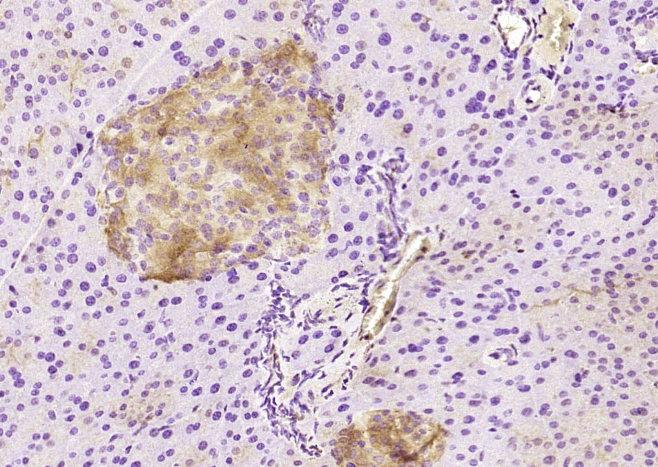 14 - PAFAH2 Rabbit pAb AP57817