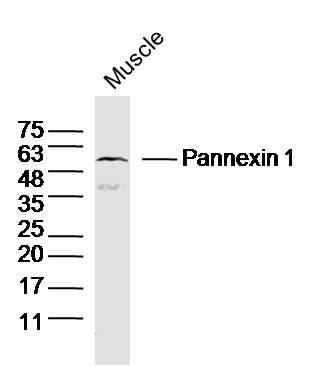 1 - Pannexin 1 Rabbit pAb AP57823