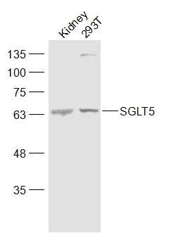 1 - SLC5A10/SGLT5 Rabbit pAb AP57825