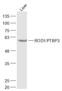 1 - ROD1/PTBP3 Rabbit pAb AP57836