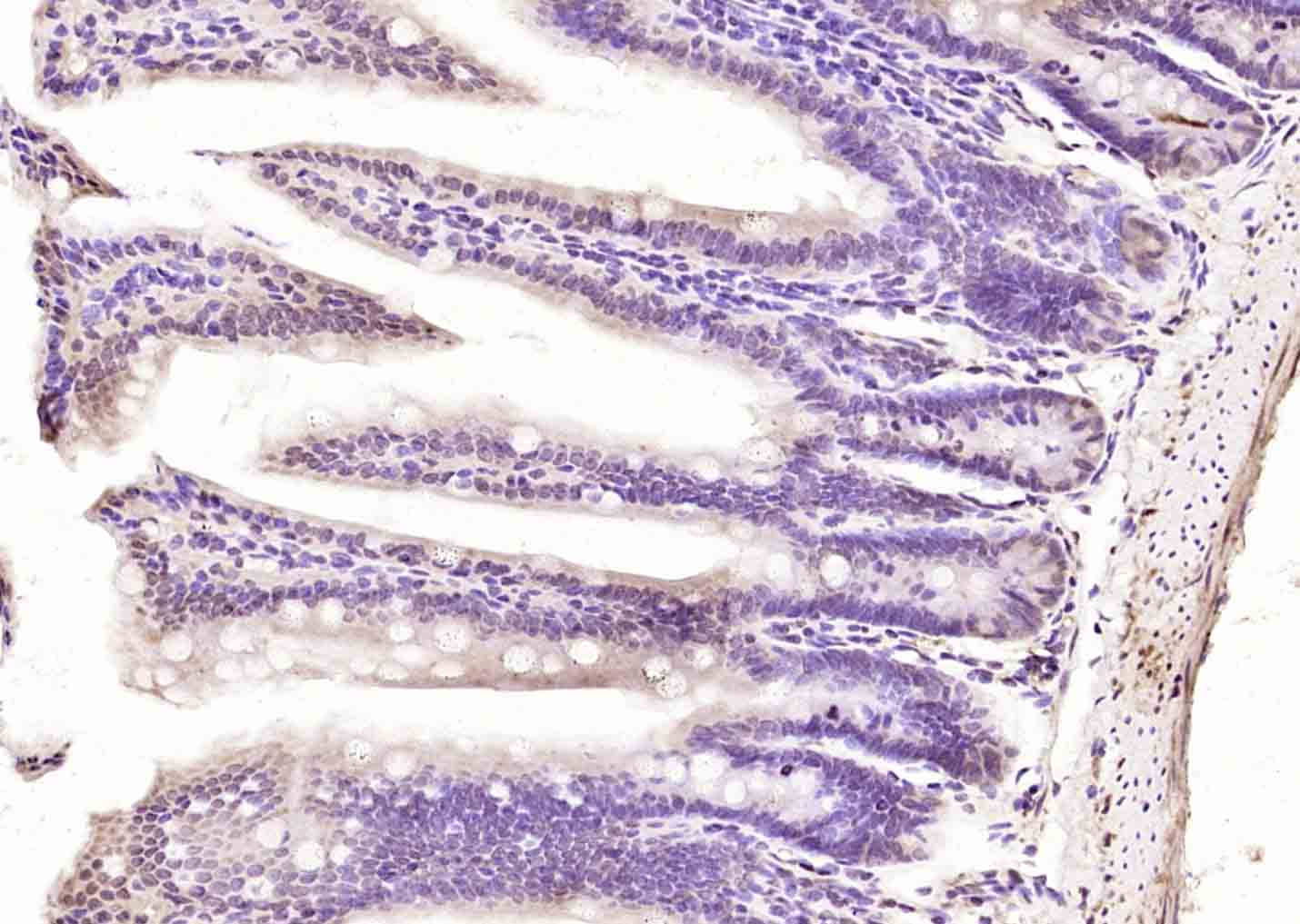 14 - POU6F1/BRN5 Rabbit pAb AP57842